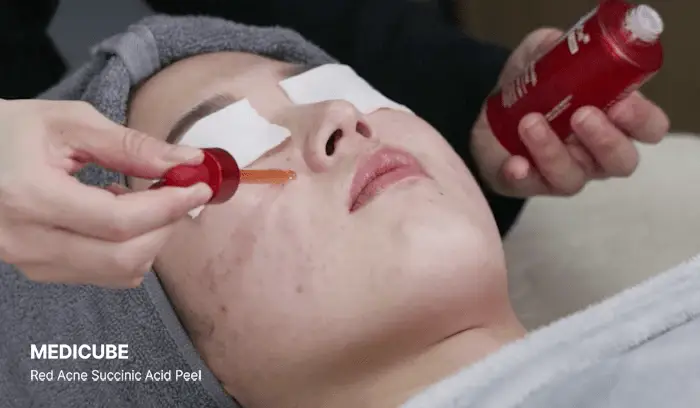 [NEW/여드름성 피부 완화 기능성] 메디큐브 레드 아크네 석시닉 애씨드 필 40g 상세페이지 8
